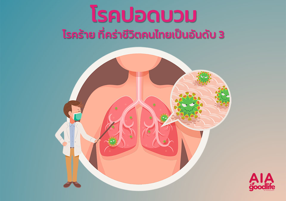 โรคปอดบวม หนึ่งใน 5 โรคร้ายที่คนไทยเสียชีวิตมากที่สุด
